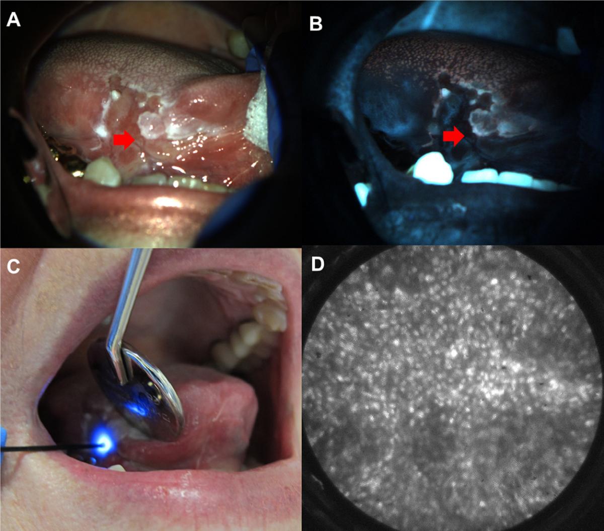Multimodal imaging example. 